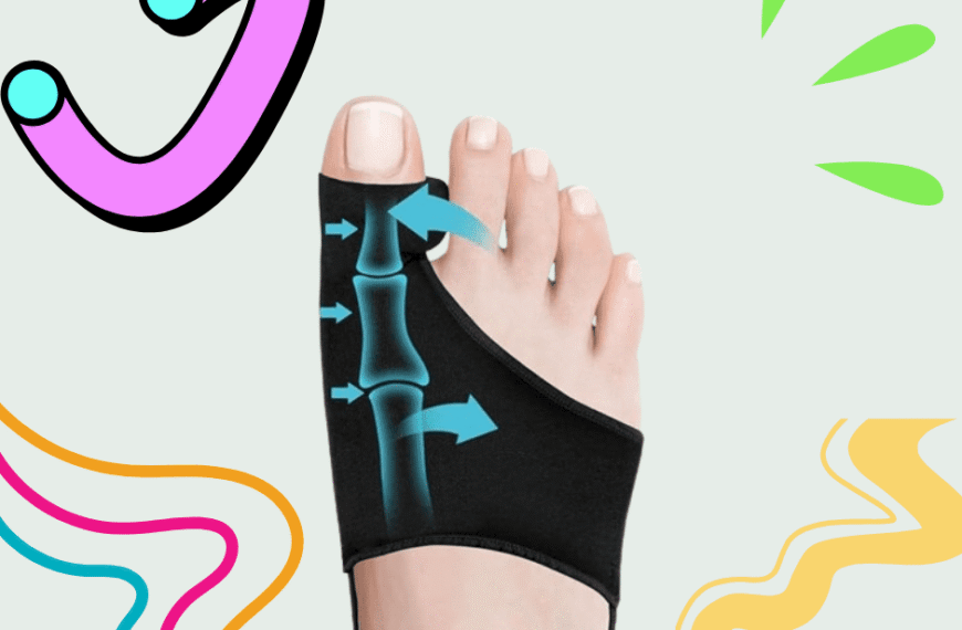 Bunion