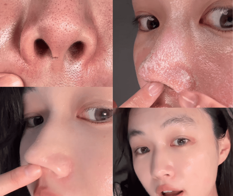 Gel face