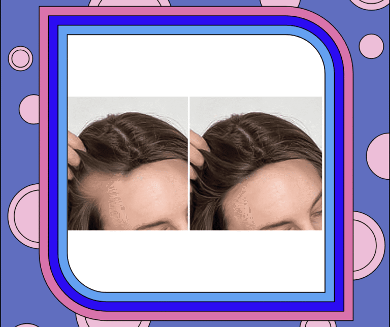 Hair growth