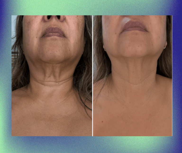 Neck