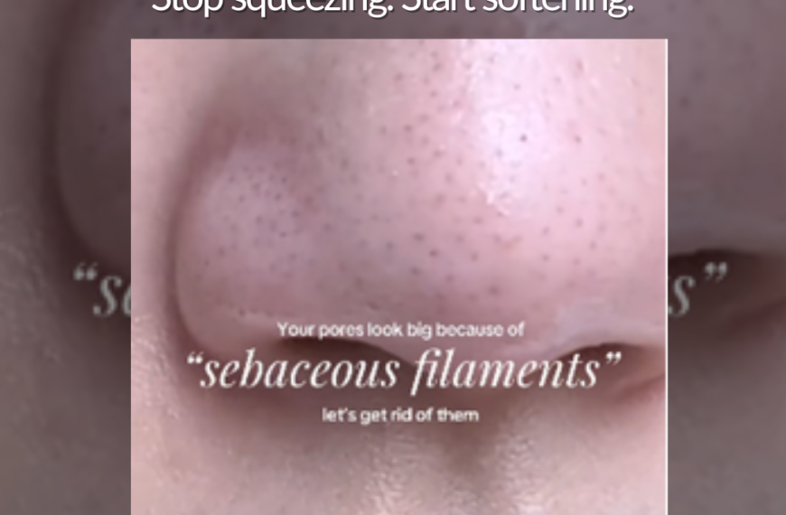 how to fix sebaceous filament