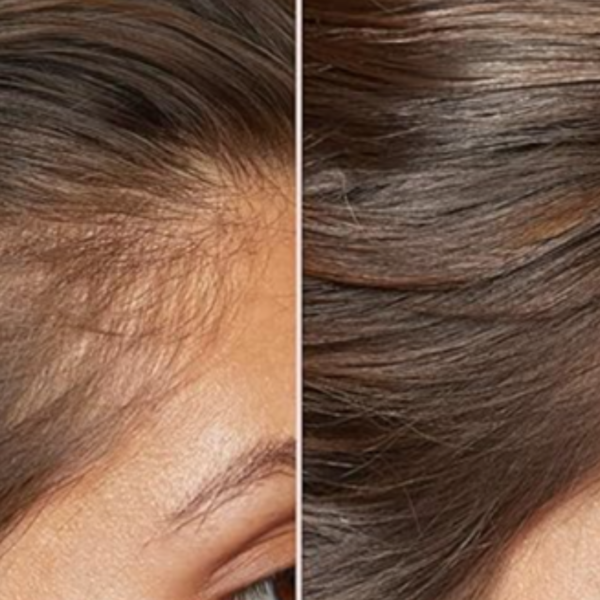 5 Scalp Serums People Reach For When Their Hair Starts Thinning