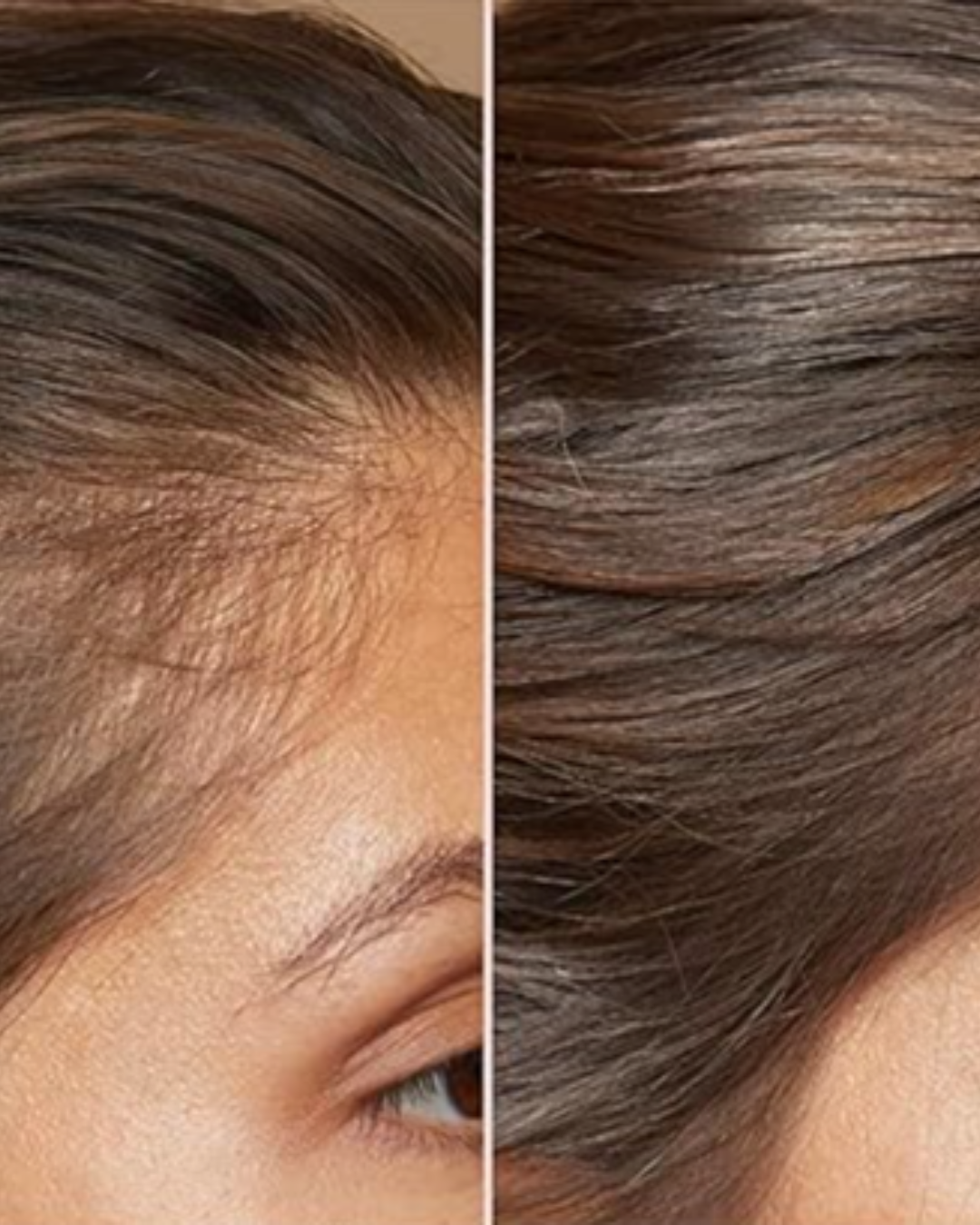 5 Scalp Serums People Reach For When Their Hair Starts Thinning
