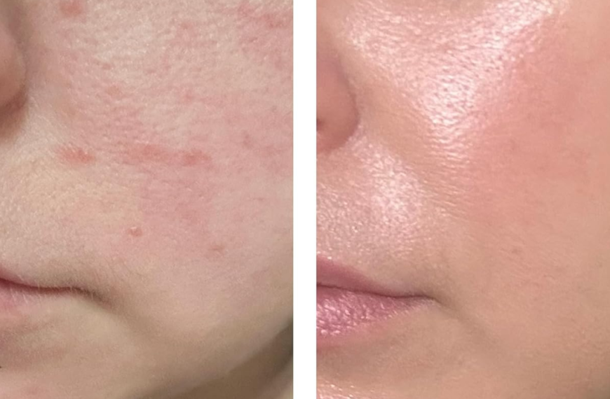 Forget 10-Step Routines: This Exosome Serum Targets Cellular Repair to Resurface Skin Texture in 14 Days
