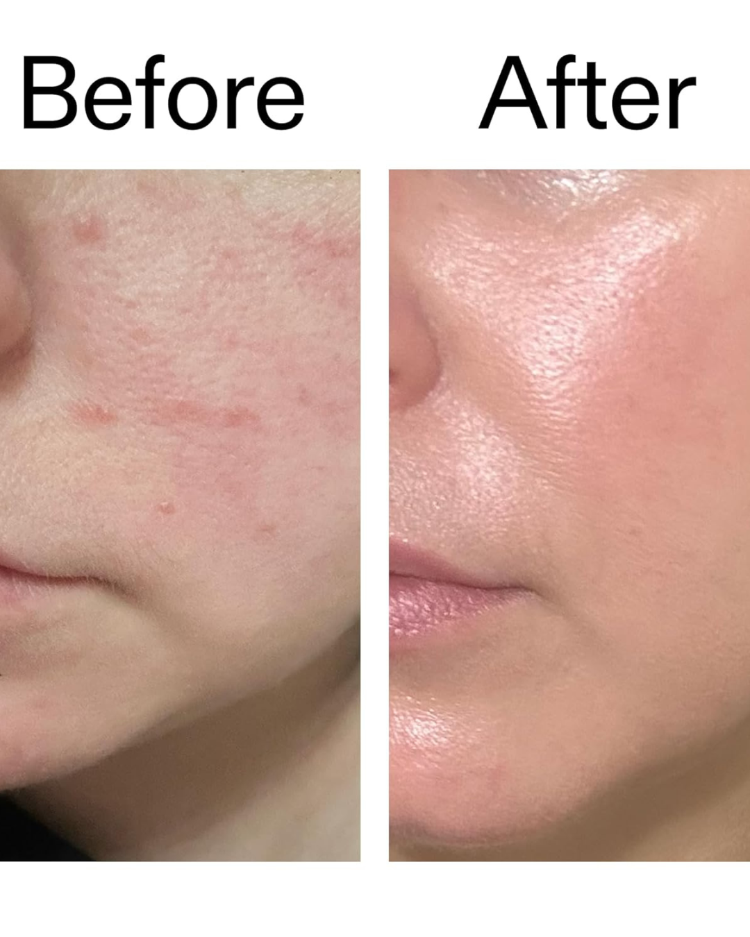 Forget 10-Step Routines: This Exosome Serum Targets Cellular Repair to Resurface Skin Texture in 14 Days