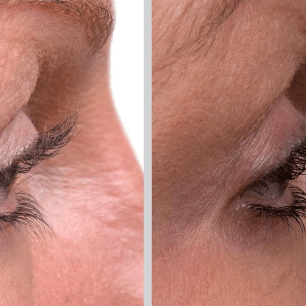 5 Affordable Amazon Lash Serums That Actually Work Without Salon Costs