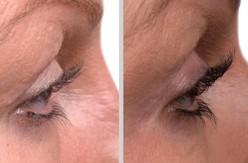 5 Lash Serums for Major Length and Volume