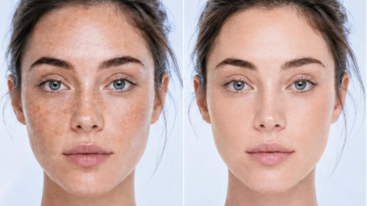 One-Step Fix for Stubborn Dark Spots, Sun Damage, and Age Spots Under $25